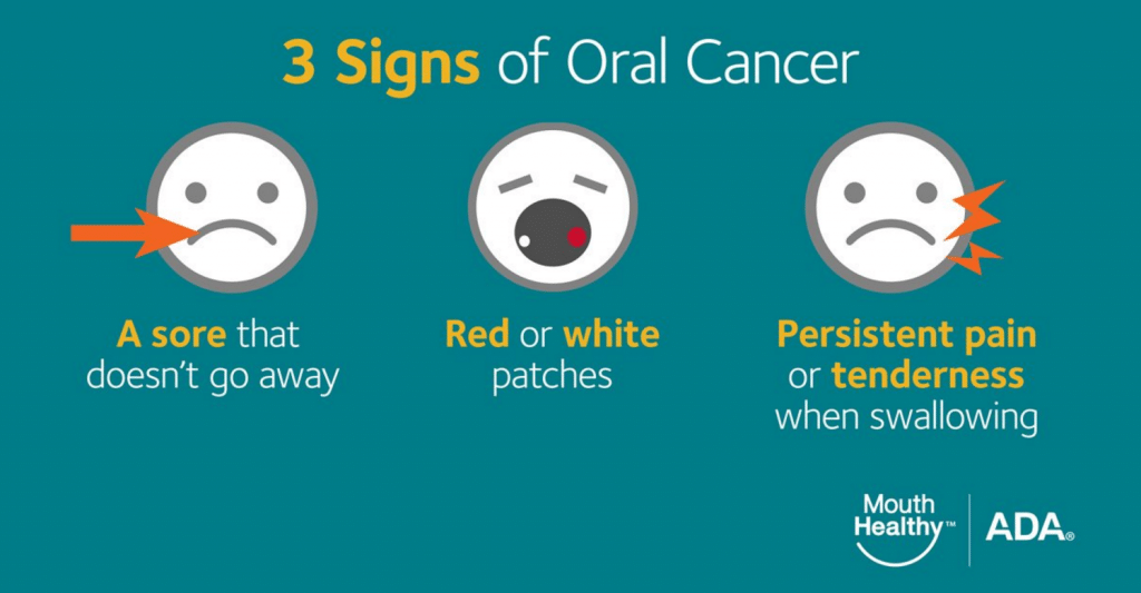 Oral Cancer Detection & Prevention