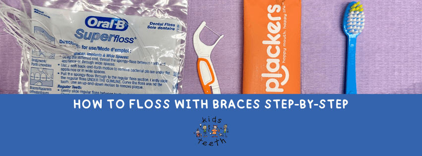 How to floss with braces step-by-step